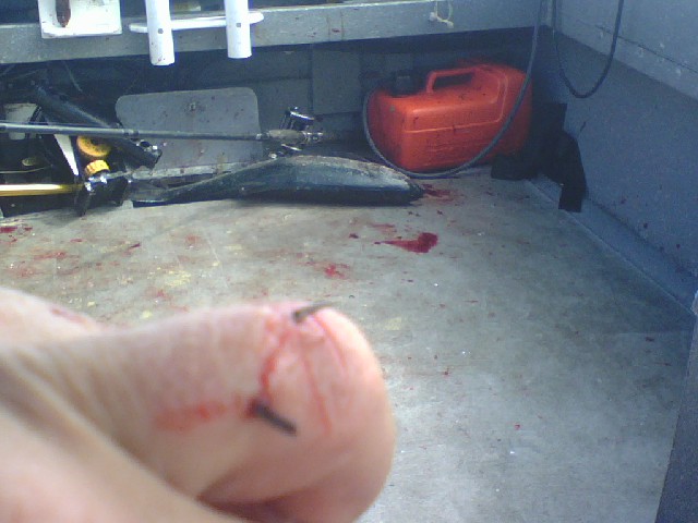 Sept_2011_Westport_hooked_finger.jpg